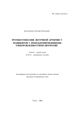 Доклад: Электрокардиостимуляторы