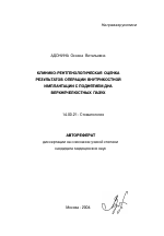 Клинико-рентгенологическая оценка результатов операции внутрикостной имплантации с поднятием дна верхнечелюстных пазух - тема автореферата по медицине