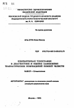 Компьютерная томография в диагностике и оценке заживления травматических повреждений нижней челюсти - тема автореферата по медицине