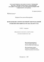 Использование антирефлексивной эндотрахеальной трубки при операциях на органах малого таза - диссертация, тема по медицине