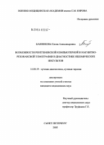 Возможности рентгеновской компьютерной и магнитно-резонансной томографии в диагностике ишемических инсультов - диссертация, тема по медицине