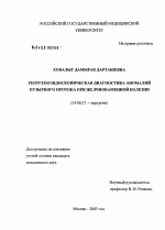 Рентгеноэндоскопическая диагностика аномалий пузырного протока при желчно-каменной болезни - диссертация, тема по медицине