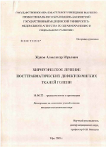 Хирургическое лечение посттравматических дефектов мягких тканей голени - диссертация, тема по медицине