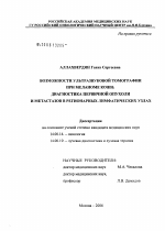 Возможности ультразвуковой томографии при меланоме кожи, диагностика первичной опухоли и метастазов в регионарных лимфатических узлах - диссертация, тема по медицине