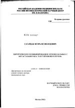Хирургическое и комбинированное лечение больных с метастазами рака толстой кишки в печень - диссертация, тема по медицине