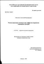 Реваскуляризация миокарда при диффузном поражении коронарных артерий - диссертация, тема по медицине