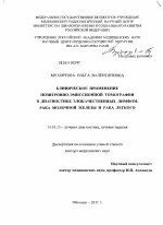 Клиническое применение позитивно-эмиссионной томографии в диагностике злокачественных лимфом, рака молочной железы и рака легкого - диссертация, тема по медицине